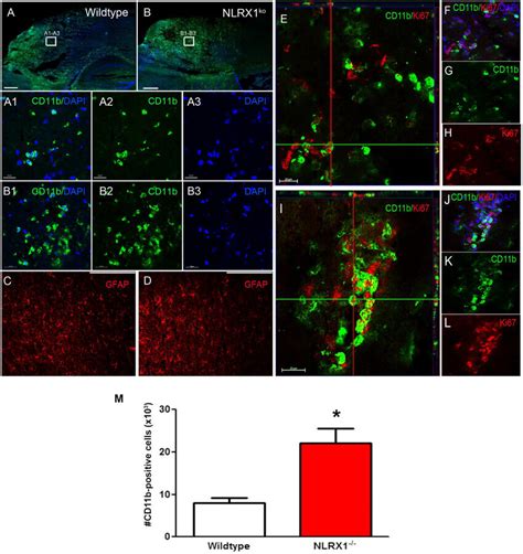 Analysis Of Microglia And Astrocyte Activation 3 D Post Cci Injury In