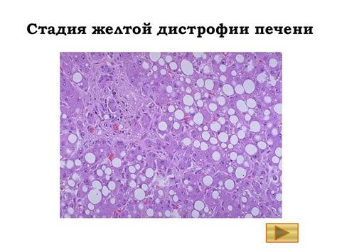 Болезни печени. Обучающая программа - презентация онлайн