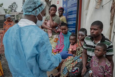 Variole Du Singe «la Rdc A Une Expertise En épidémies 24 Heures