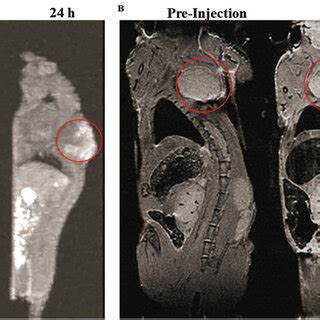 In Vivo MRI Of HT1080 Tumor Bearing Nude Mice With TiO2 Gd Tf NPs The