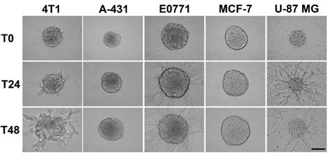 A Cancer Cell Spheroid Assay To Assess Invasion In A 3D Setting