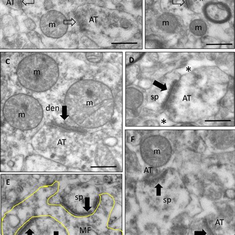 Electron Micrographs Showing Synaptic Types In Different Regions