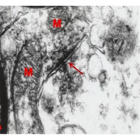 Electron microscopy of CA1 area of hippocampus: (a) control, (b ... 