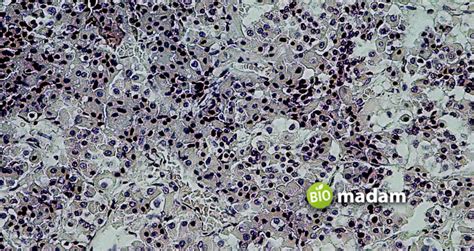 Main Function of Astrocytes - biomadam