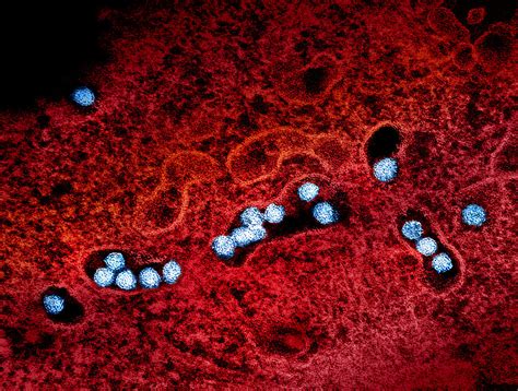 West Nile Virus Transmission Electron Micrograph Of West N Flickr