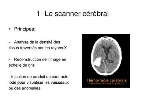 Ppt Anatomie Et S Miologie En Neurologie Powerpoint Presentation