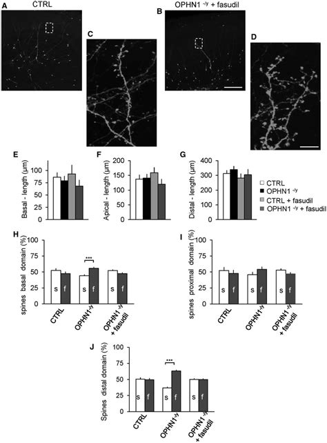 Treatment With Rho Kinase ROCK Inhibitor Fasudil Rescued The