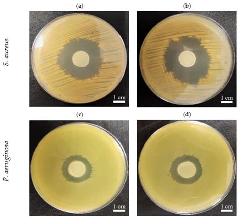 The Growth Inhibition Zones In S Aureus Atcc 6538 And P Aeruginosa