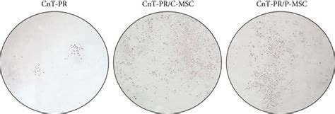 Coculture Of Mscs And Limbal Epithelial Cells Lecs And Colony Forming