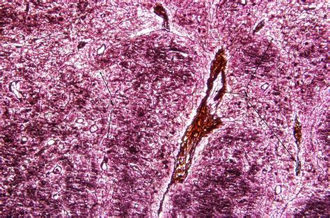 Reticular Fibers Lymph Node