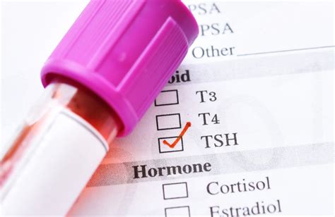 TSH Receptor Antibody TRAb Test Unveiling Its Purpose