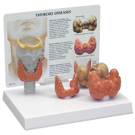 Thyroid Cartilage Model