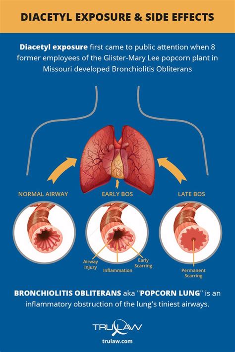 Bronchiolitis Obliterans Popcorn Lung Disease Diacetyl Exposure Popcorn Plant Lunges Health