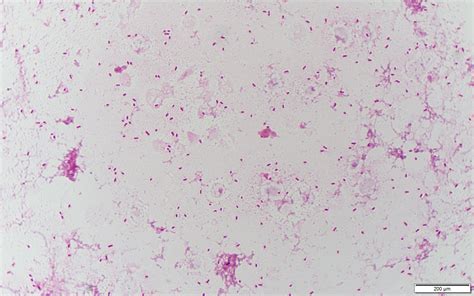 Enterococcus avium〔レア腸球菌〕 | グラム染色: Gram Stain