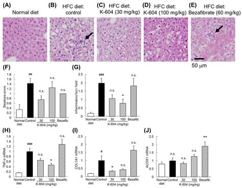 Steatosis Hepatic Inflammation And Gene Expression In The Ldlr