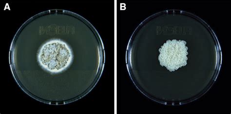 Paracoccidioides Spp Isolated From Blood Cultures Macroscopic View Of