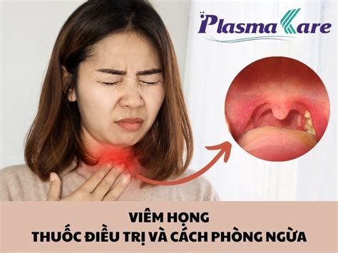 Viêm Họng Uống Thuốc Gì Cách Phòng Ngừa Hiệu Quả