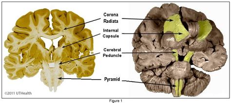 Neuroanatomy Online Lab Descending Pathways To The Spinal Cord