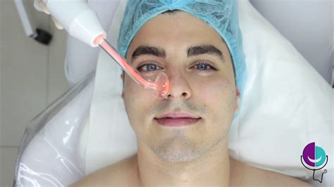 LIMPIEZA FACIAL HOMBRE Bucaramanga - Tratamiento facial paso a paso ...