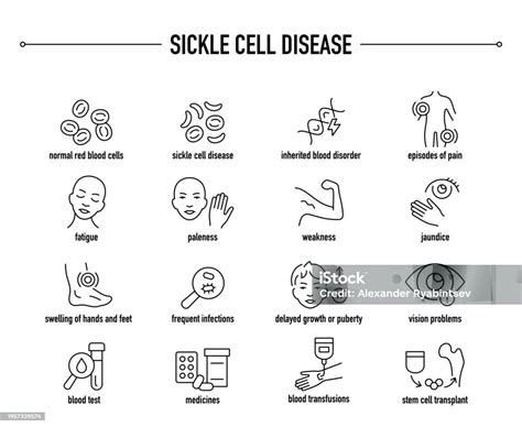 Sickle Cell Disease Symptoms Diagnostic And Treatment Vector Icons ...