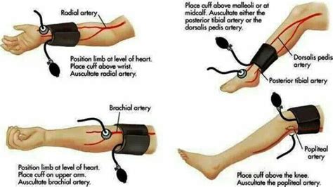 Manual Bp On Leg