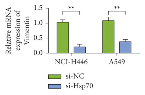 Cell Level Proves That Knocking Down Hsp Inhibits The Malignant