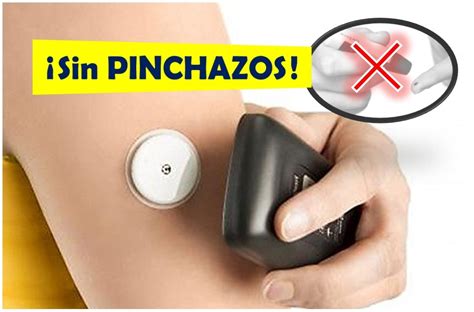 Diabetes Medir La Glucosa Sin Pinchazos Ya Es Posible