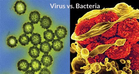 9 Perbedaan Virus Dengan Bakteri Muhammad Ihwan