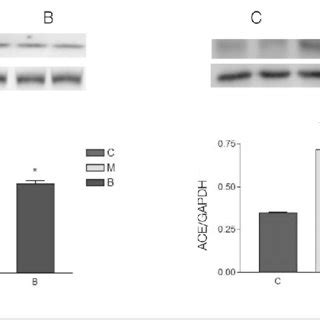 ACE Protein Contents By Western Blot Analysis ACE Protein Contents