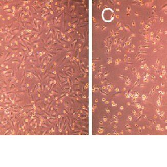 The Effect Of Shikonin On The Morphology Of A549 Cells A Control