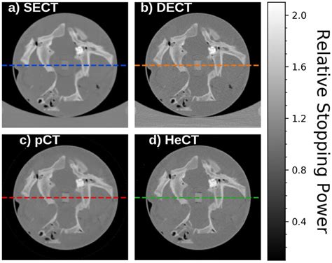 Slice Through The Reconstructed CT Scans From A SECT B DECT C