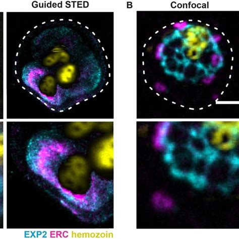 Two Colour Imaging Of Parasite Structures Using Guided Sted Confocal