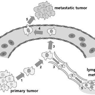 Molecular mechanism of metastasis. To produce a tumor metastasis tumor... | Download High ...