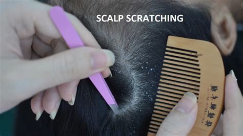 ASMR Scalp Check Real Person Scalp Picking Scalp Scratching With