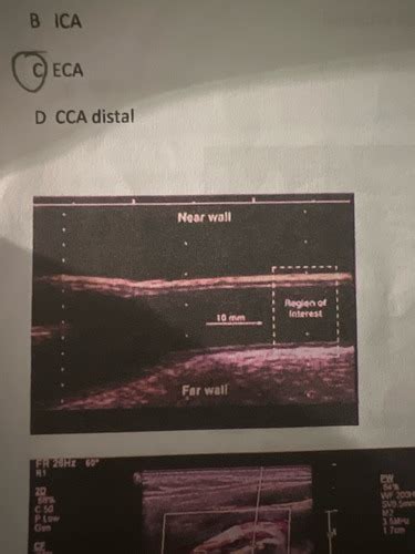 VAS 1 Exam Packet Flashcards Quizlet