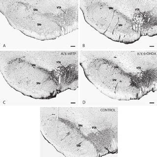 Bright Field Photomicro Graphs Illustrating Representative Tyrosine