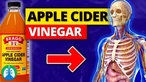 Top 10 Benefits Of Apple Cider Vinegar Youll Wish You Knew Sooner