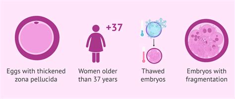 Assisted Hatching Before Embryo Transfer