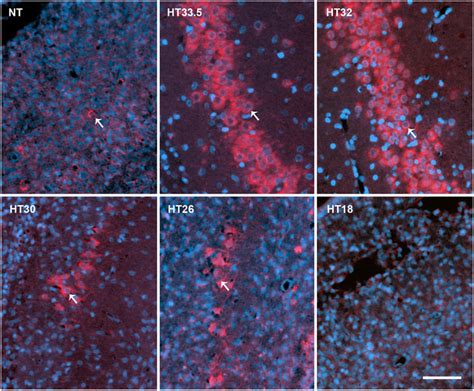 Hippocampal Immunohistochemistry Representative Ca Hippocampal