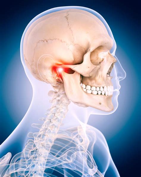 Temporomandibular Joint Tmj Disorders Diagnosis And Treatment