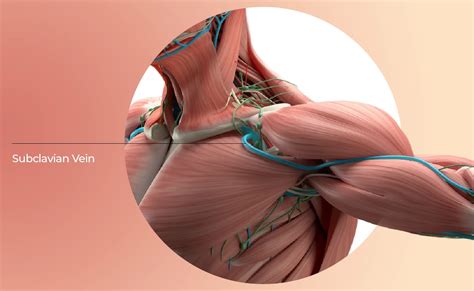 Thoracic Outlet Syndrome Curezone Physiotherapy