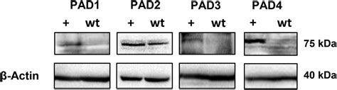 PAD2 Is Expressed In The Gonadotrope Derived LT2 Cell Line Protein