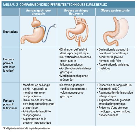 Reflux gastro œsophagien et chirurgie de lobésité La Revue du Praticien