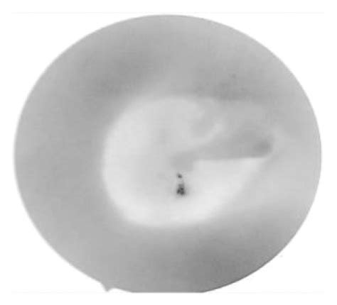 A normal right eardrum: (a) white image, (b) red image, (c) green ...