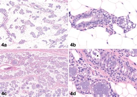 Histopathology Of The Mammary Gland In Rats Treated With Exemestane At