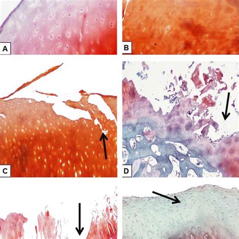 Histological Sections Representing Different Grades Of Cartilage Download Scientific Diagram