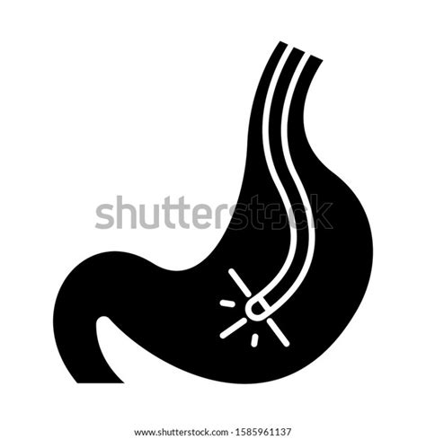 Endoscopy Glyph Icon Gastroscopy Process Medical Stock Vector Royalty