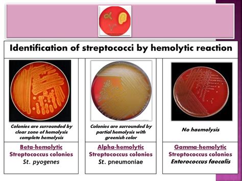 Alpha Hemolytic Strep Antibiotics