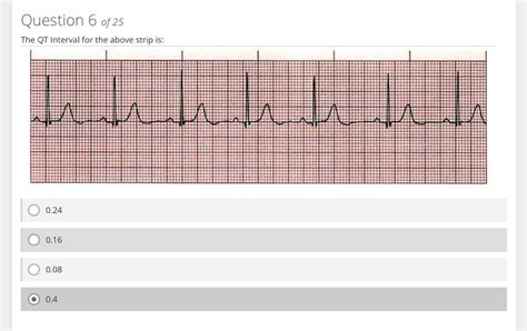 Solved Need Help With These ECG Rhythm Interpretations Pl