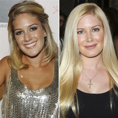 Heidi Montag Before Plastic Surgery Telegraph